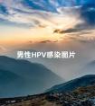 男性HPV感染图片