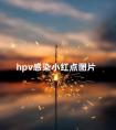 hpv感染小红点图片